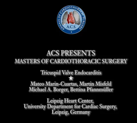 Tricuspid valve endocarditis