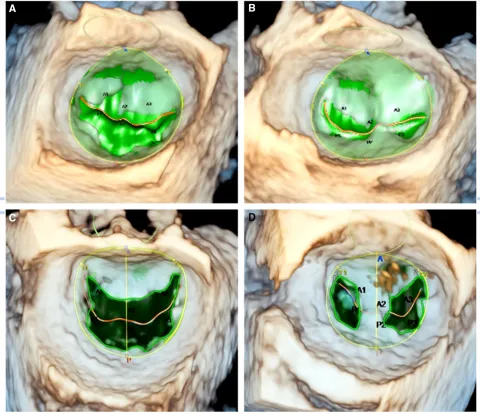 DOI: 10.1161/JAHA.123.030333